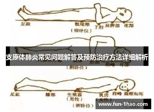 支原体肺炎常见问题解答及预防治疗方法详细解析